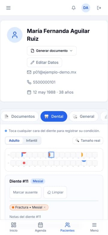 Odontograma con dientes marcados dentro del expediente